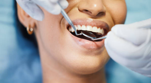 Best Emergency Cosmetic Dentistry (e.g., broken veneers) in Temple Hills, MD