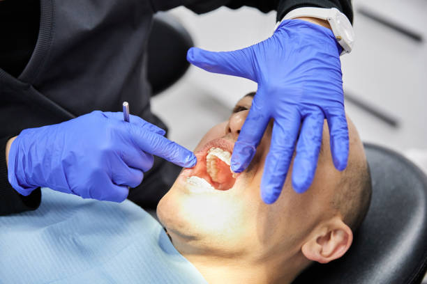 Best Emergency Wisdom Tooth Extraction in Temple Hills, MD